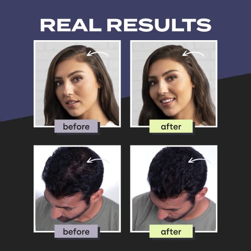 Toppik Hair Building Fibers, Средно кафяво, 27,5 g | Изпълва Фините или Изтъняване на косата | Незабавно ги прави по-гъсти и буйни